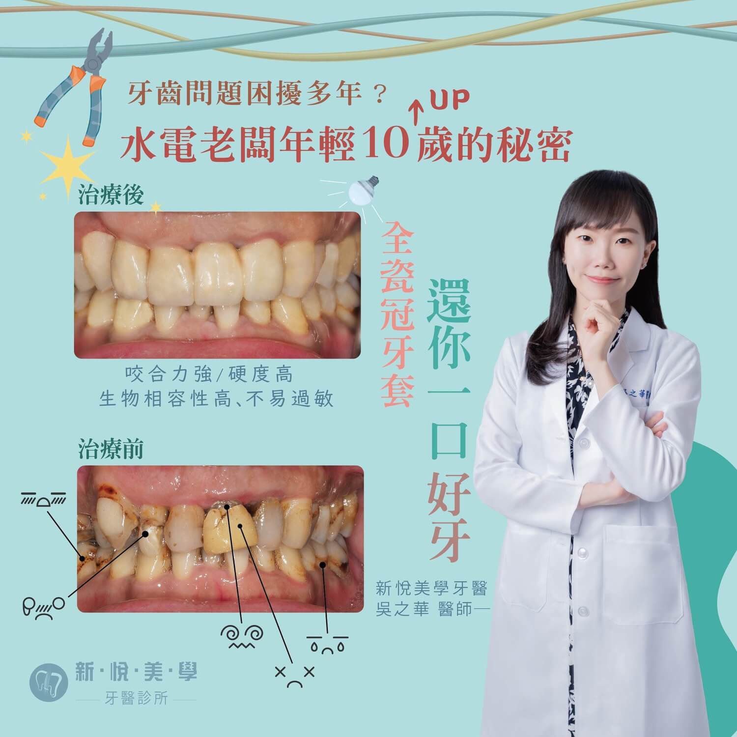 新悅美學牙醫診所的案例分享圖片